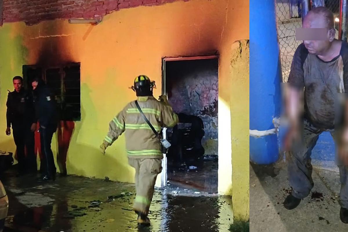 Falleció El Hombre Que Sufrió Severas Quemaduras Tras Un Incendio En Su